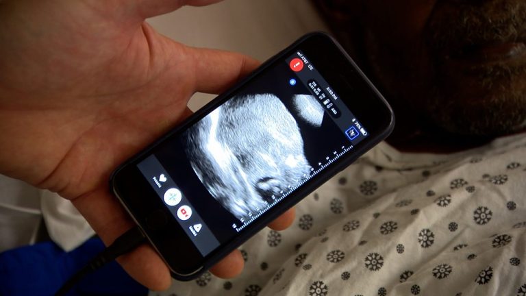 Aplicativo de Ultrassom para Celular